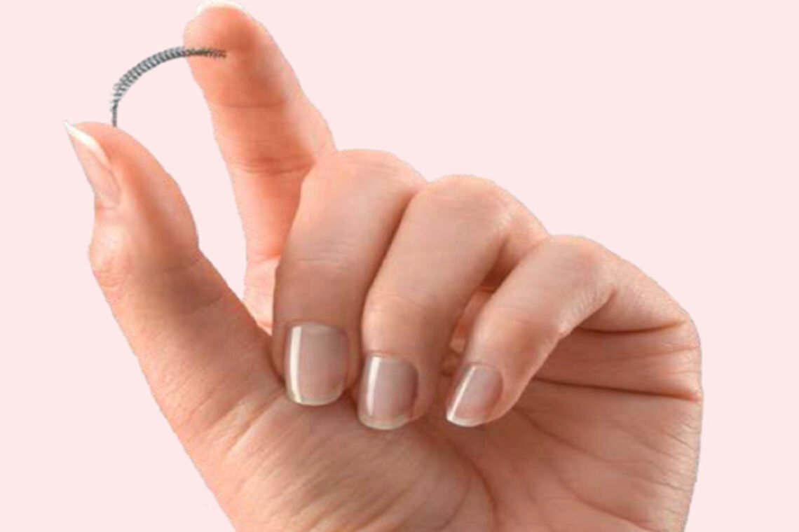 Essure: o dispositivo contraceptivo que causa sequelas